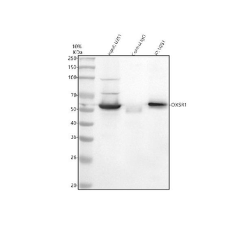 Anti-OXSR1 Antibody