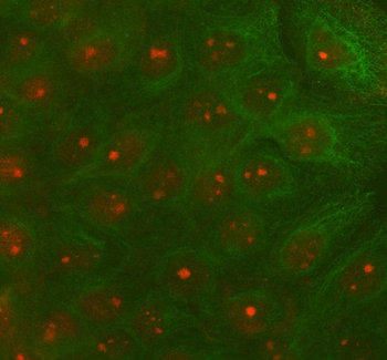 Anti-RAD51D Antibody