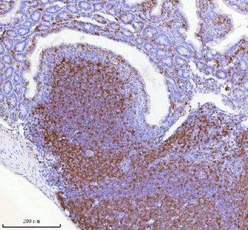 Anti-Lat Antibody