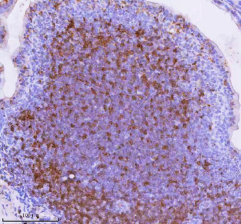 Anti-Lat Antibody
