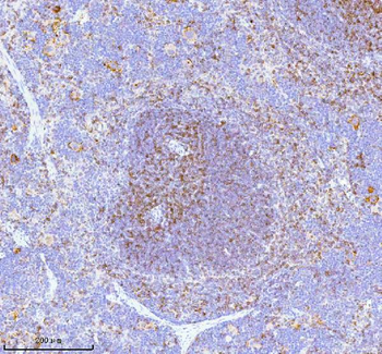 Anti-Lat Antibody