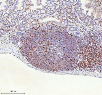 Anti-Lat Antibody