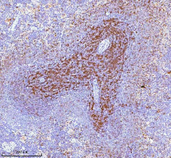 Anti-Lat Antibody