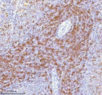 Anti-Lat Antibody