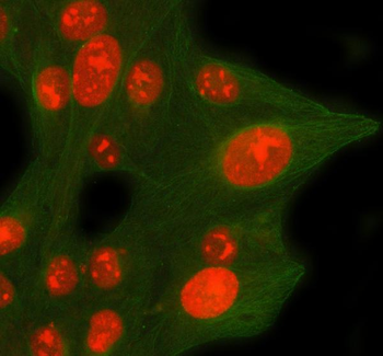 Anti-CDCA8 Antibody