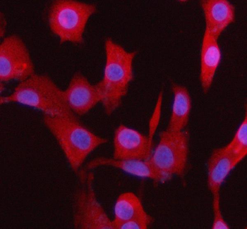 Anti-BCCIP Antibody