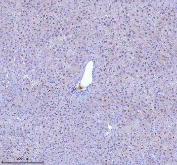 Anti-BCCIP Antibody