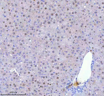 Anti-BCCIP Antibody