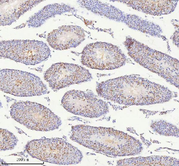 Anti-BCCIP Antibody