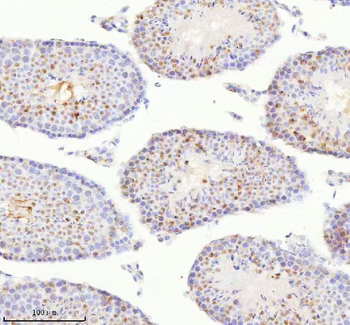 Anti-BCCIP Antibody