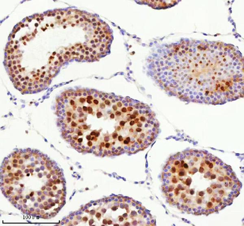 Anti-BCCIP Antibody