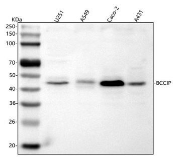 Anti-BCCIP Antibody