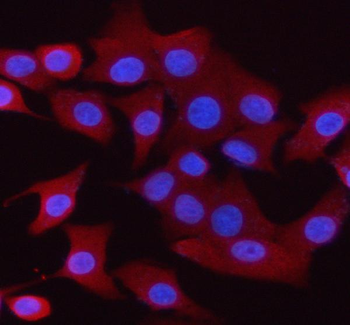 Anti-Synaptogyrin 1 Antibody