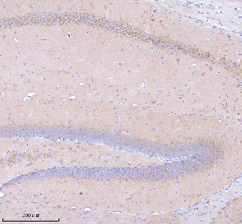 Anti-STXBP6 Antibody