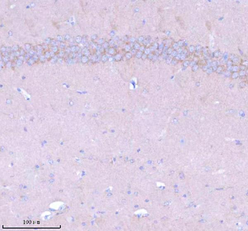 Anti-STXBP6 Antibody