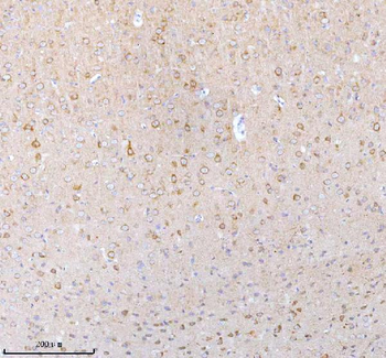 Anti-STXBP6 Antibody