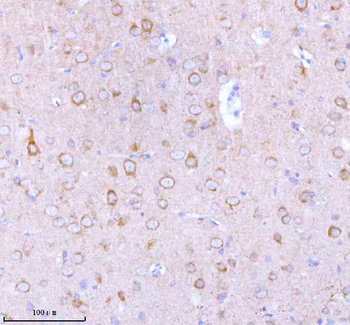 Anti-STXBP6 Antibody