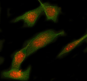 Anti-Syntaxin 12/STX12 Antibody