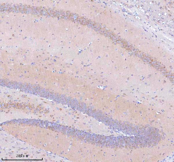 Anti-STRIP1 Antibody