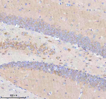 Anti-STRIP1 Antibody