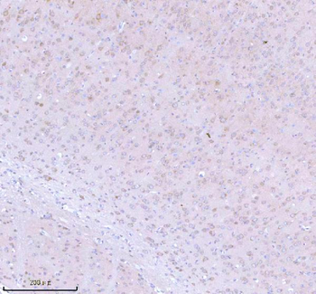 Anti-STRIP1 Antibody