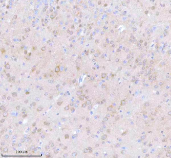 Anti-STRIP1 Antibody