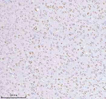 Anti-STRIP1 Antibody