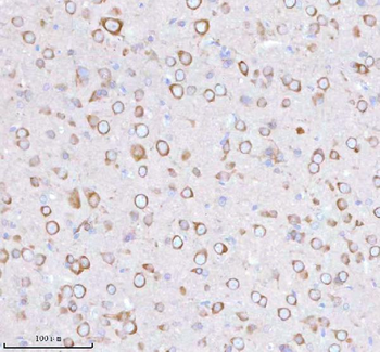 Anti-STRIP1 Antibody