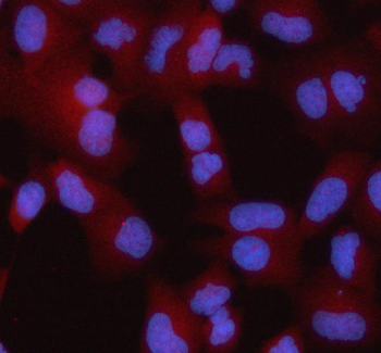 Anti-STRBP Antibody