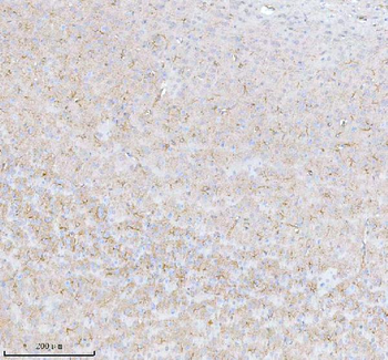 Anti-STRBP Antibody