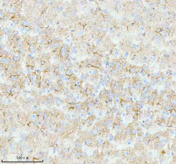 Anti-STRBP Antibody