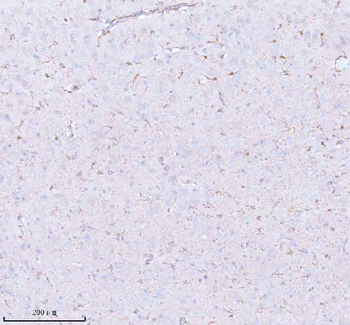 Anti-STRBP Antibody