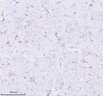 Anti-STRBP Antibody