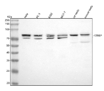 Anti-STRBP Antibody