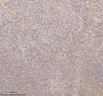 Anti-SSX2IP Antibody