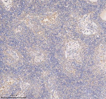 Anti-SSX2IP Antibody