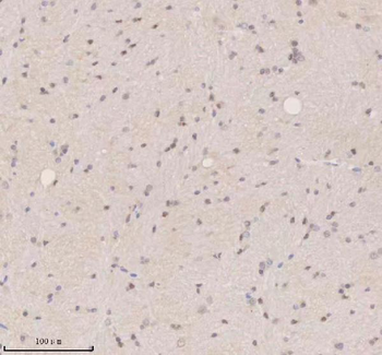 Anti-SSX2IP Antibody