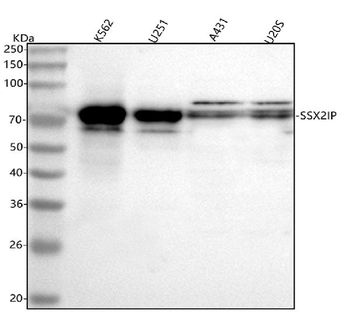 Anti-SSX2IP Antibody