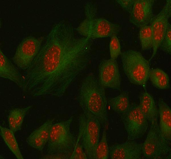 SSH3 Antibody