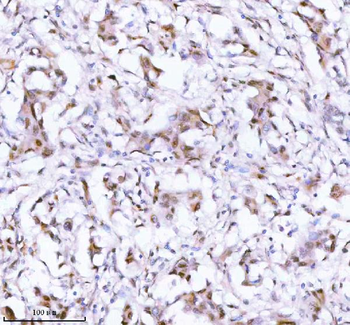 SSH3 Antibody