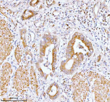 SSH3 Antibody