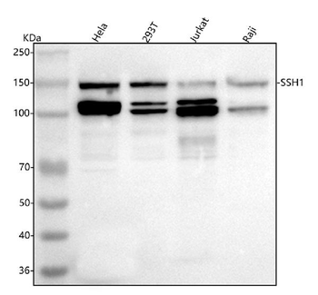 Anti-SSH1 Antibody