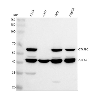Anti-STK32C Antibody