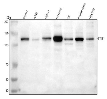 Anti-STK31 Antibody