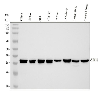Anti-STK16 Antibody