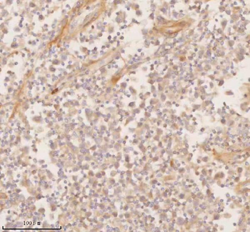 Anti-SSSCA1/ZNRD2 Antibody