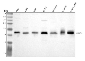 Anti-SSSCA1/ZNRD2 Antibody