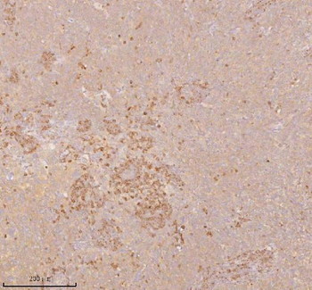 Anti-SSSCA1/ZNRD2 Antibody