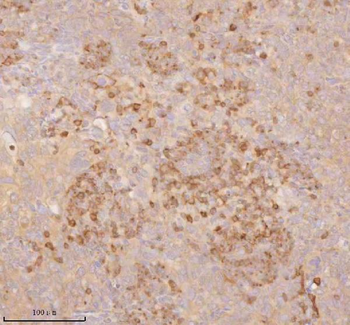 Anti-SSSCA1/ZNRD2 Antibody