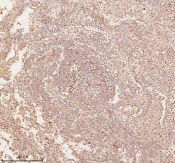 Anti-SSSCA1/ZNRD2 Antibody